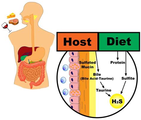 Dietary Factors in Sulfur Metabolism and Pathogenesis of Ulcerative Colitis