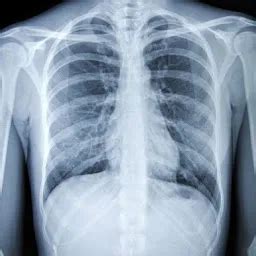 Ultrasound, CT Scan, Xray, MRI, Blood test Lab Center in Zirakpur ...