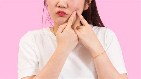 See Dr. Pimple Popper Extract "Rose Cyst" in New Popping Video | Allure