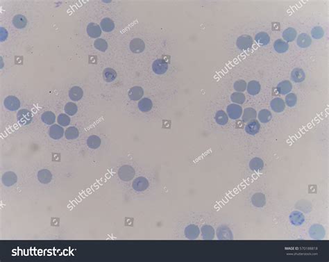 Stain Medical Definition at Roberta Shanklin blog