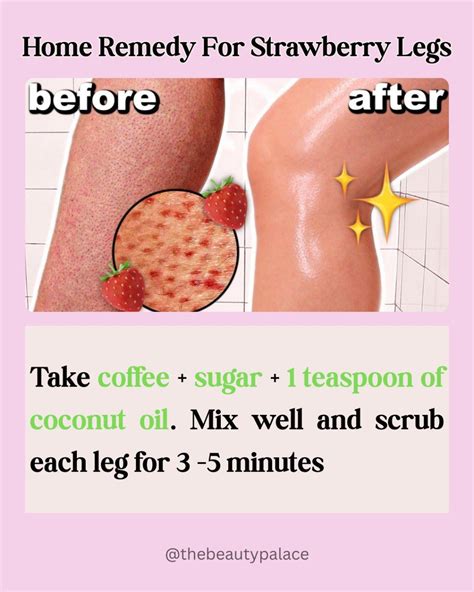 Best 13 How to Get Rid of Strawberry Leg in 1 day with Lemon & Sugar / Remove Keratosis Pilaris ...