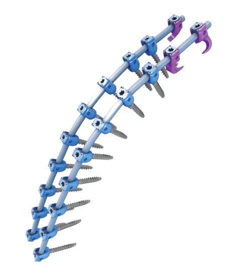 Image result for Spinal Fixation