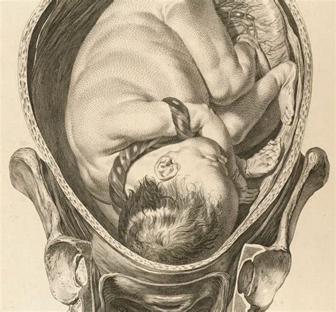 Bildergebnis für umbilical cord around neck complications