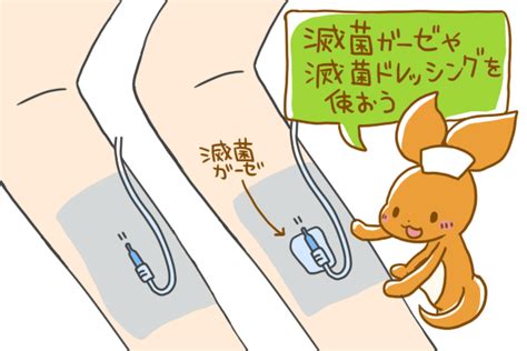 末梢静脈カテーテル固定の正解は？｜血管内留置カテーテルのガイドラインをわかりやすく解説！ | 看護roo![カンゴルー]