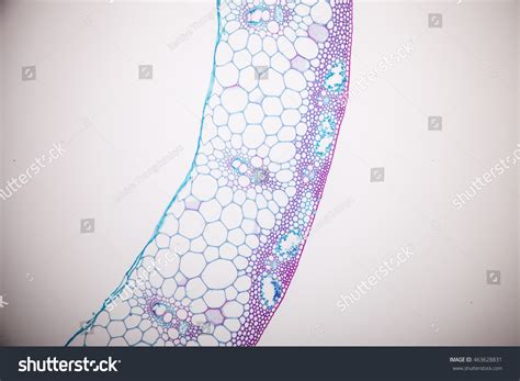 Sclerenchyma Under Microscope