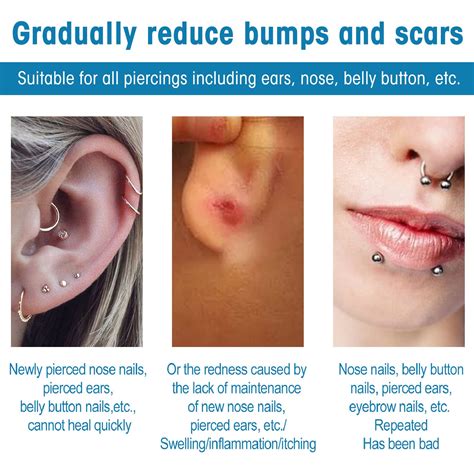 Belly Button Piercing Infection Bubble