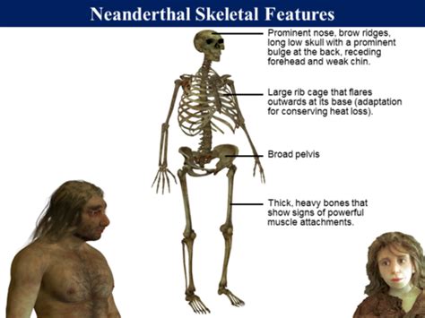 Image result for Skeleton Brain Exploding