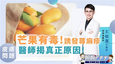 夏天吃芒果有毒! 蕁麻疹發作好痛苦! 王俊潔醫師揭露真正原因!你也能安心吃芒果 - YouTube