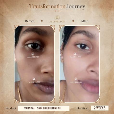 Varnyah Skin Brightening Pack | Best Facial Pack for Glowing Skin ...