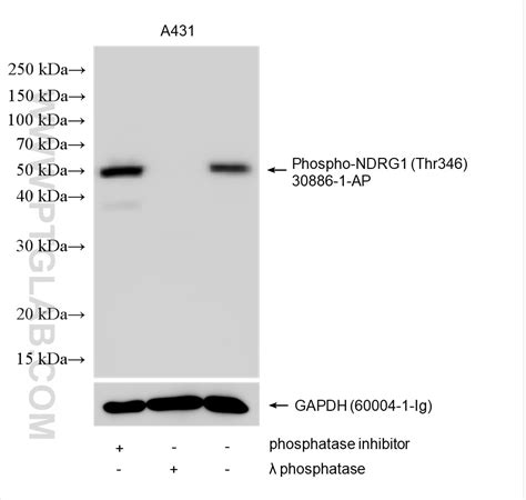 Phospho-NDRG1 (Thr346) antibody (30886-1-AP) | Proteintech