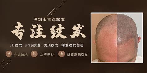 49_汕头脱发修复纹发咨询，3D纹发无痛_深圳市青逸纹发