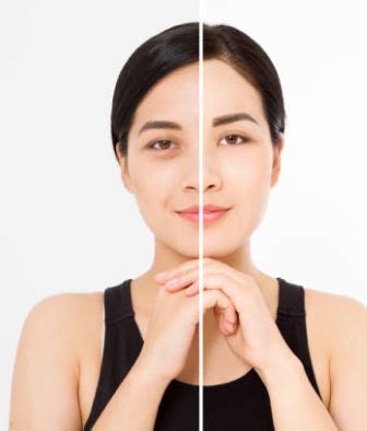 Eloura - Skin and Plastic Surgery Clinic in Bangalore