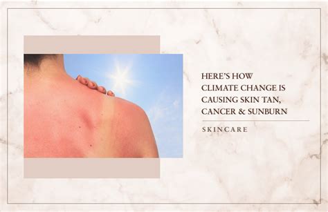 Just Herbs Why Climate Change Is Causing Skin tan, Cancer & Sunburn