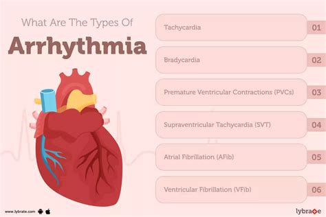 Arrhythmia Definition 的图像结果