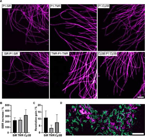 Image result for Super-Resolution Microscopy