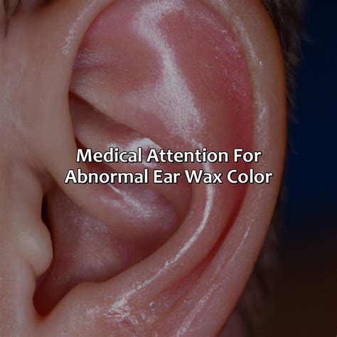 What Color Is Ear Wax - colorscombo.com