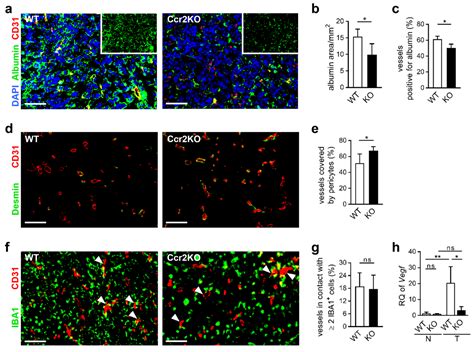 CCR2 of Tumor Microenvironmental Cells Is a Relevant Modulator of ...