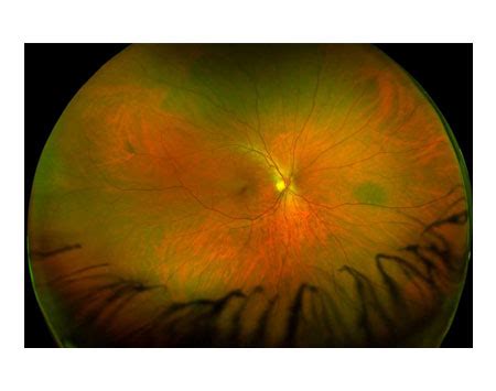 Image result for Deep Learning Algorithmic
