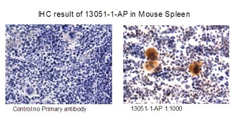 RAB37 antibody (13051-1-AP) | Proteintech