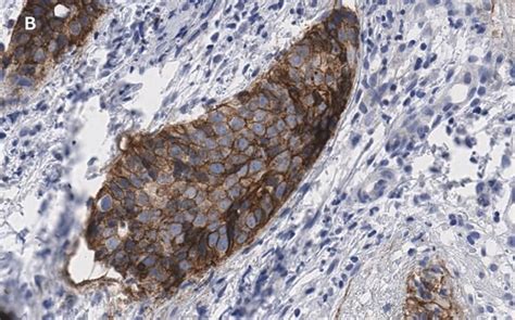 Anti-EpCAM Antibody, clone 1B8 , ZooMAb® Rabbit Monoclonal recombinant ...