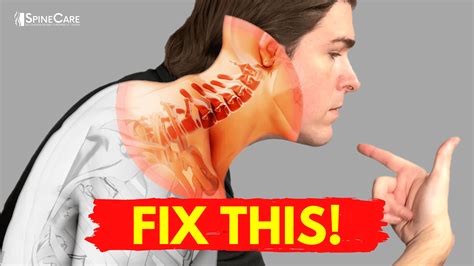 Exercises For Compressed Neck at Sandra Mathers blog