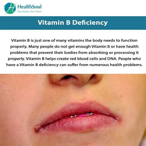 Vitamin B12 Deficiency Symptoms Mouth at Callum Coombes blog