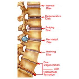 Knee Pain Treatment in Chennai, Best Physiotherapy Clinic Chennai