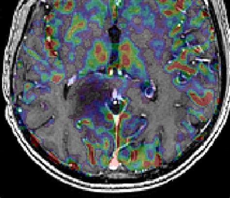 Image result for fMRI Python
