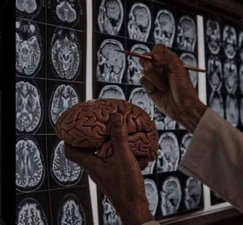 What does a vascular neurologist do – Artofit