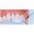 GI Dental Matrix Strips Straight – Dentalmantraa