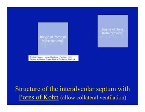 11.10.08(d): Histology of the Respiratory Tract | PDF
