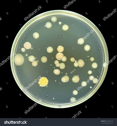 Colonies Of Bacteria From Sea Water On A Petri Dish (Agar Plate ...