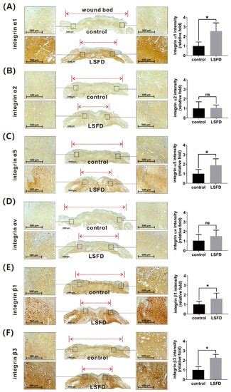 Cutaneous Regeneration Mechanism of β-Sheet Silk Fibroin in a Rat Burn ...