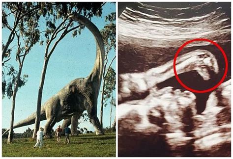 英国孕妇B超扫描图像惊现《侏罗纪公园》电影中的恐龙 - 神秘的地球 科学|自然|地理|探索