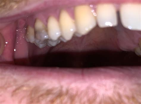 Image result for Grey Tooth