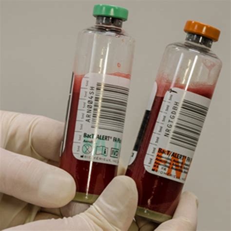 What is a Blood Culture? | Dr. Narender Saini