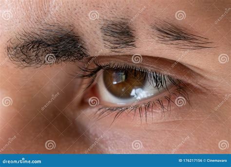 Scar on Eyebrow, Eyebrow Slit, Eyebrow Closeup Stock Photo - Image of ...