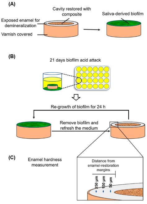 Novel Nanocomposite Inhibiting Caries at the Enamel Restoration Margins ...