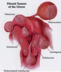 Dr. S D Mahapatra - Laparoscopic Hysterectomy Surgeon Kolkata