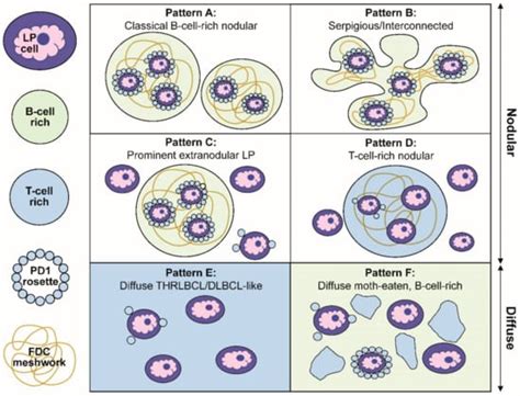 Pitfalls in the Diagnosis of Nodular Lymphocyte Predominant Hodgkin ...