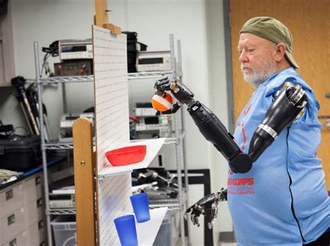 Watch The First Man On Earth To Control Two Artificial Arms With His ...
