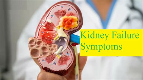 2 changes seen in urine are the beginning of kidney failure; identify ...