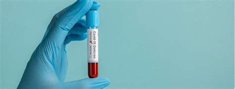 Image result for Method Using HIV Testing