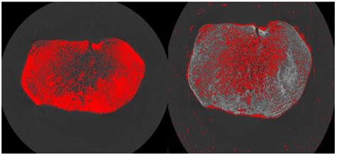Ontogenetic Patterning of Human Subchondral Bone Microarchitecture in ...