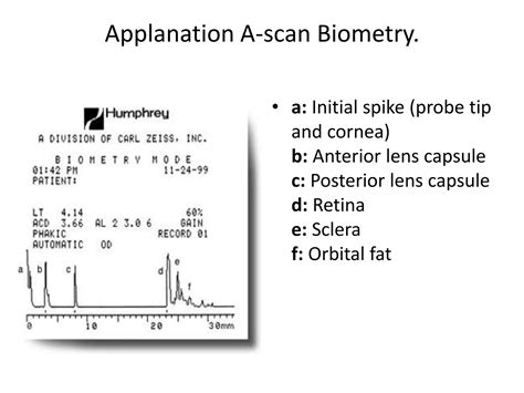 Image result for What Is an a Scan Biometry