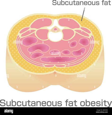 Menopause Subcutaneous Fat at Frances Chavez blog