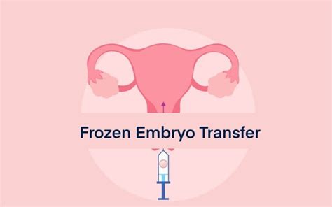 Image result for Embryo Transfer Success