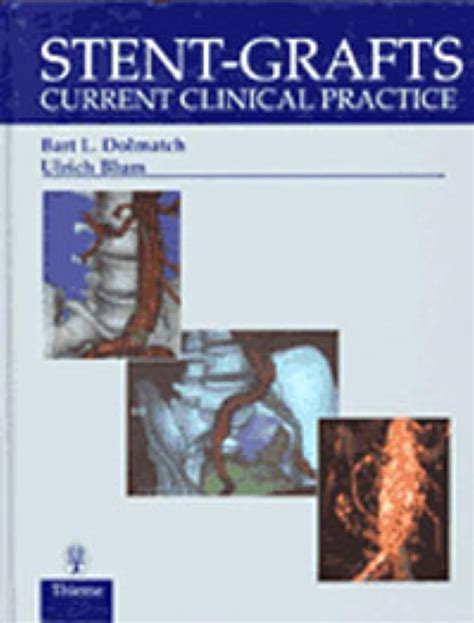 Buy STENT-GRAFTS: CURRENT CLINICAL PRACTICE 1/E Book Online at Low ...
