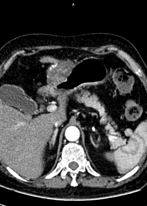 Radioloksabha - Articles
