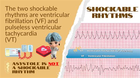 Pulseless Ventricular Tachycardia Ventricular Tachycardia